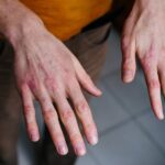 Cómo cuidar las manos en invierno para evitar grietas
