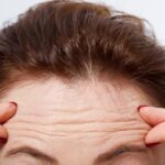 Cómo prevenir naturalmente las arrugas faciales prematuras