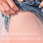 Cómo prevenir y tratar estrías en axilas durante embarazo