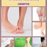 Qué es el pie diabético y cómo aliviarlo naturalmente